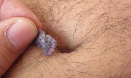 Why cotton like material are found in navel
